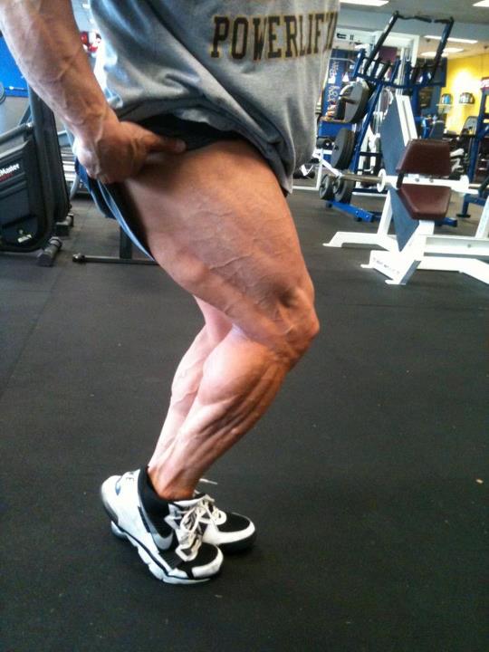 Vince Galanti