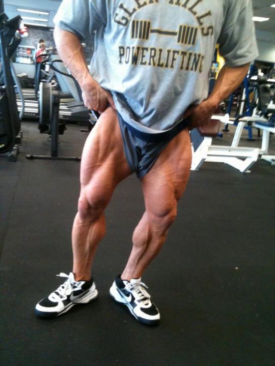Vince Galanti