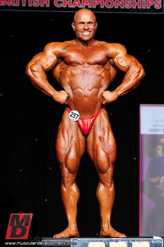 Anthony Bailes
