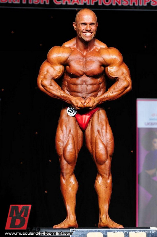 Anthony Bailes