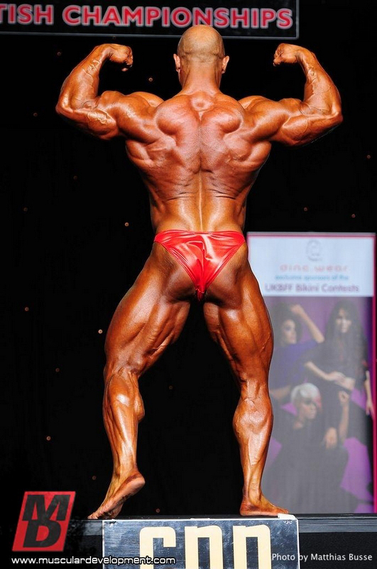 Anthony Bailes