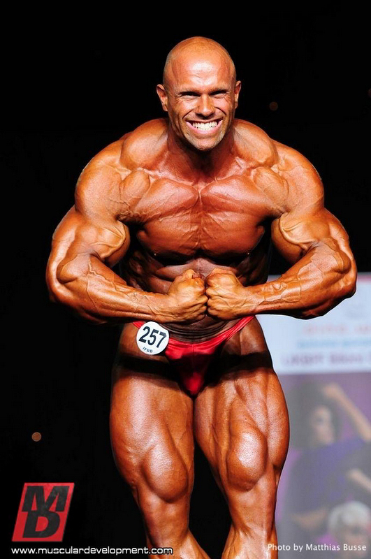 Anthony Bailes