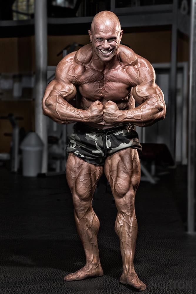 Anthony Bailes