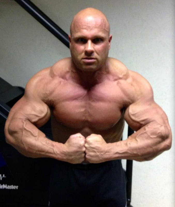 Anthony Bailes
