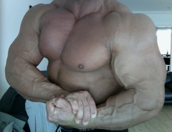 Anthony Bailes