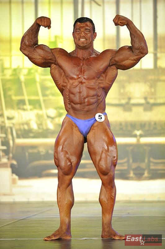Tony Breznik
