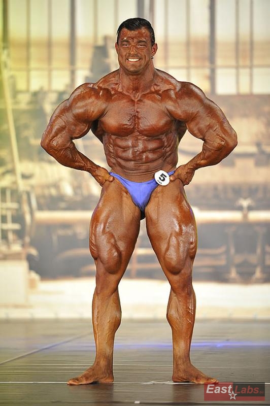 Tony Breznik