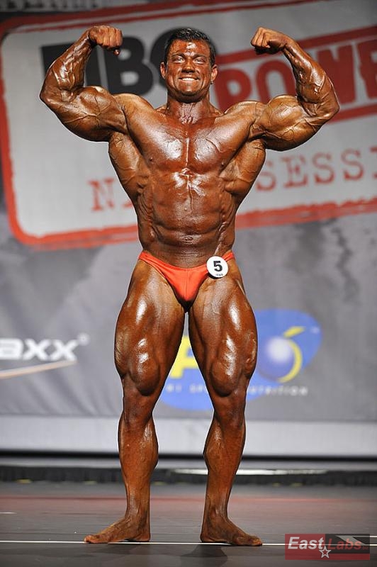 Tony Breznik