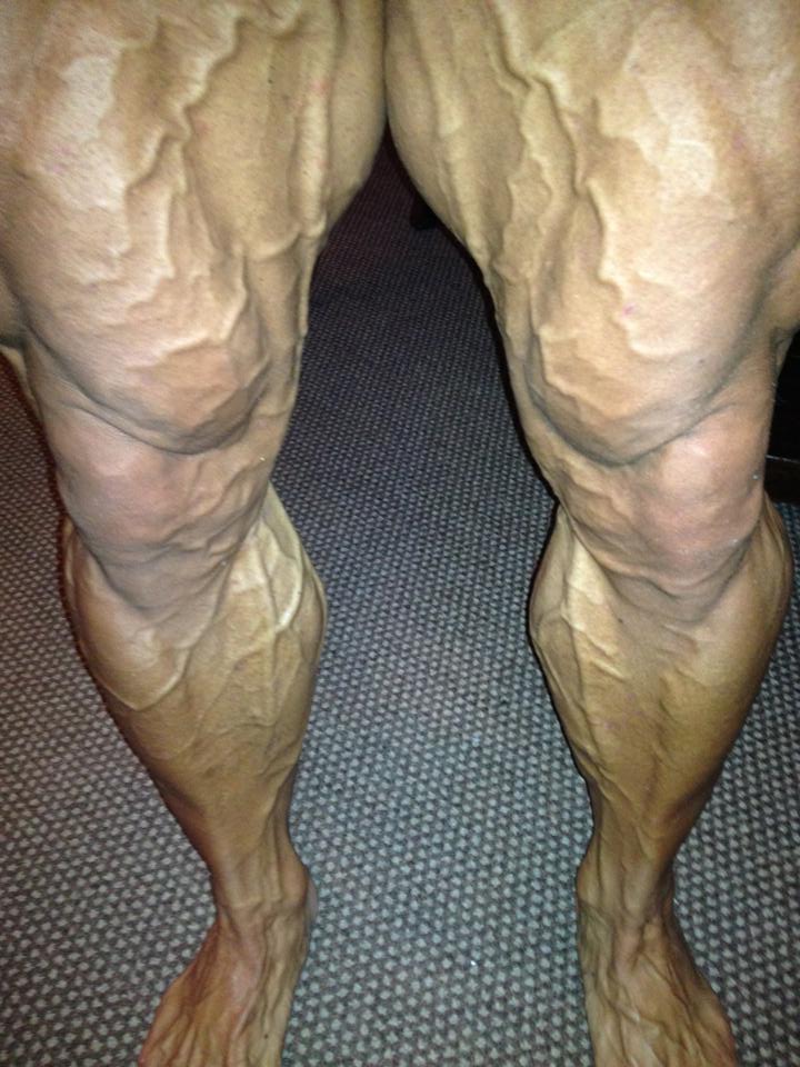 Lee Priest