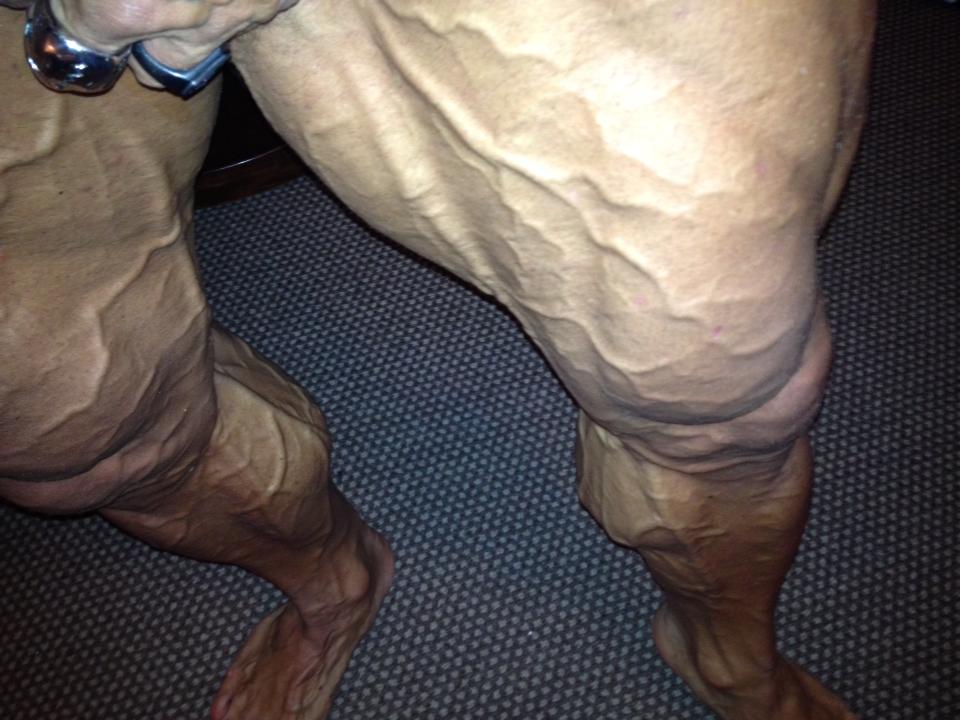 Lee Priest