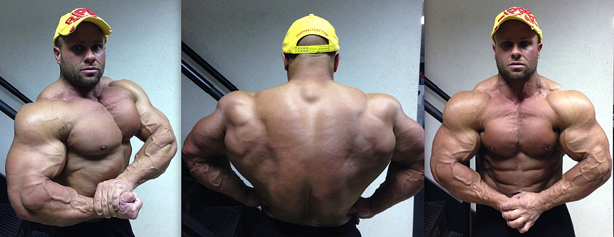 Anthony Bailes