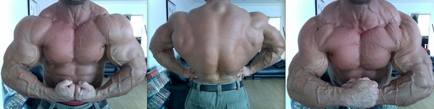 Anthony Bailes
