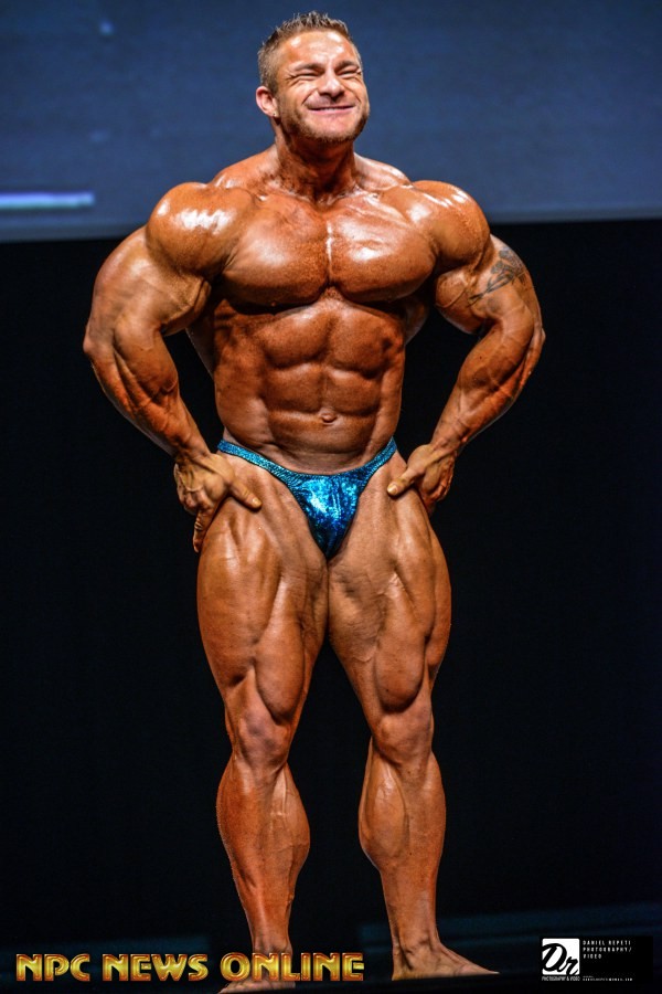 James "Flex" Lewis