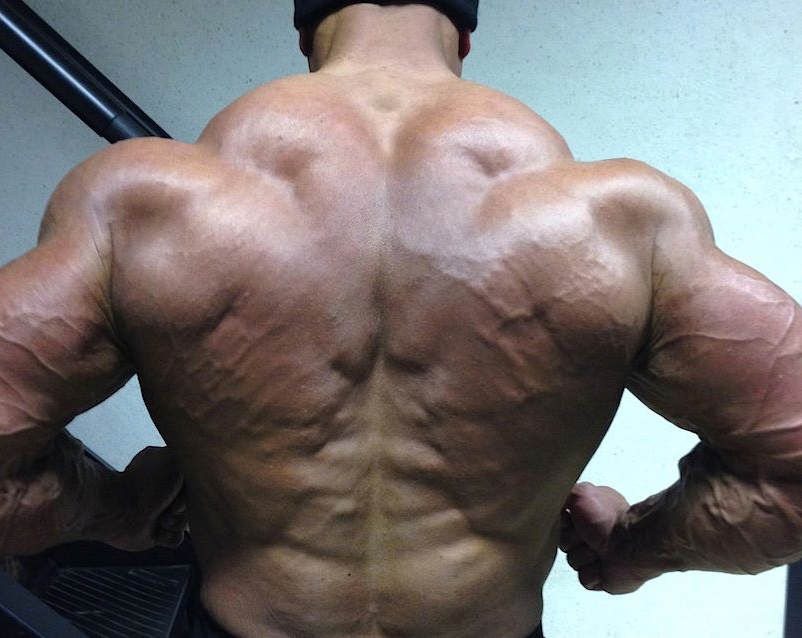 Anthony Bailes