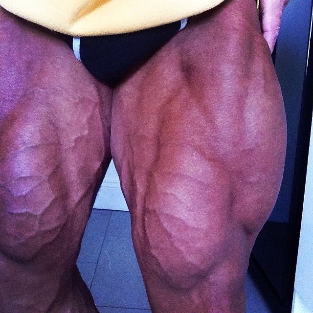 Anthony Bailes