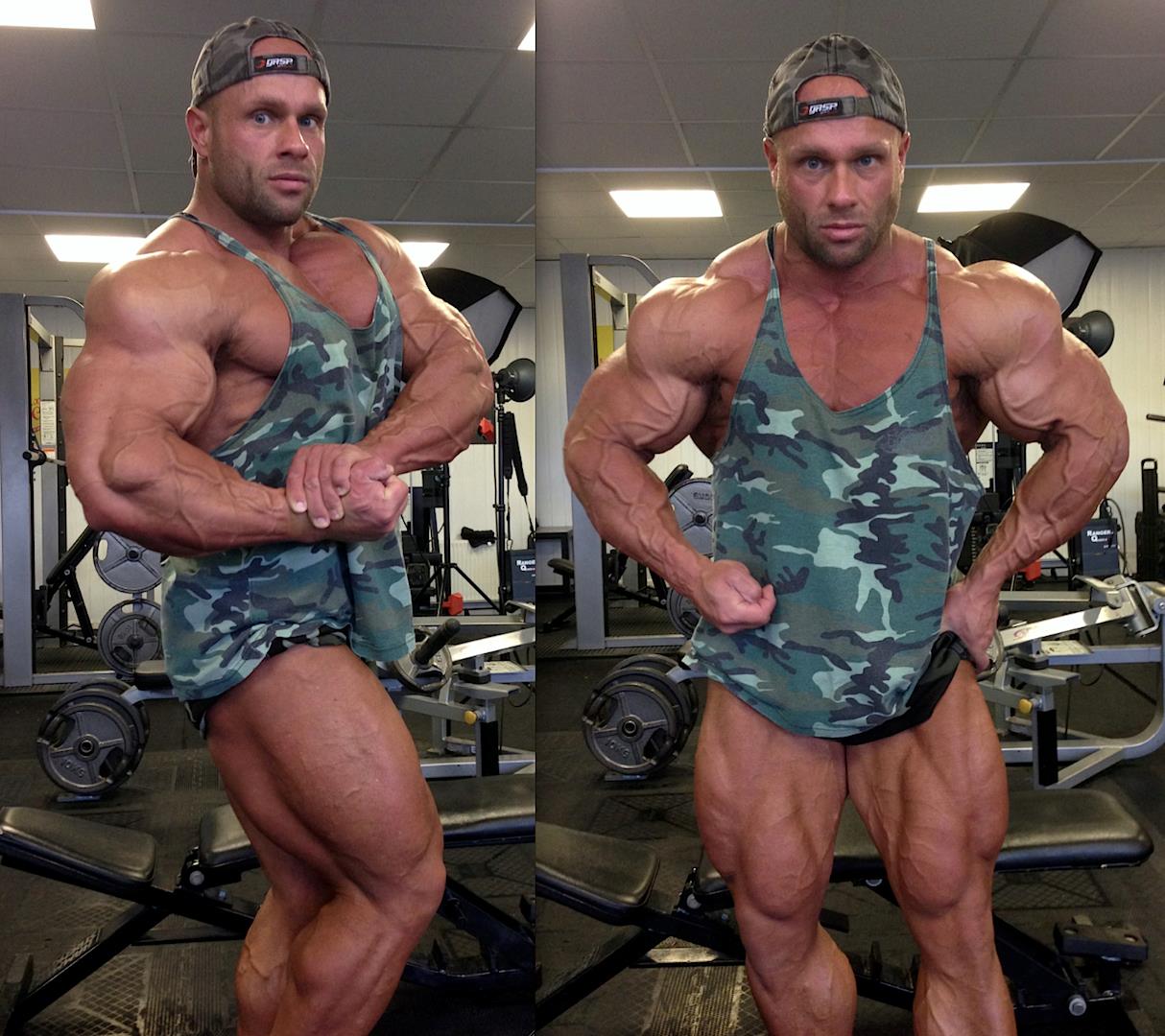 Anthony Bailes
