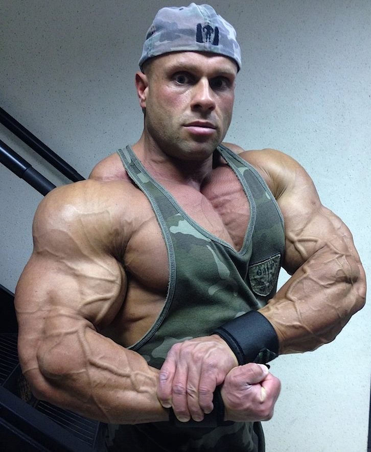Anthony Bailes