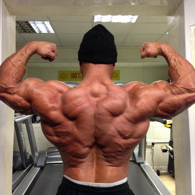 Anthony Bailes