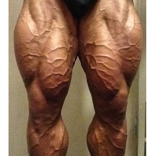 Anthony Bailes