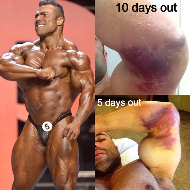 Eduardo Correa a jeho zran�n� tricepsu p�ed Olympia 212 Showdown 2013