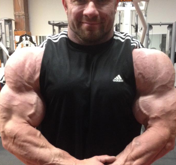 Ronny Rockel