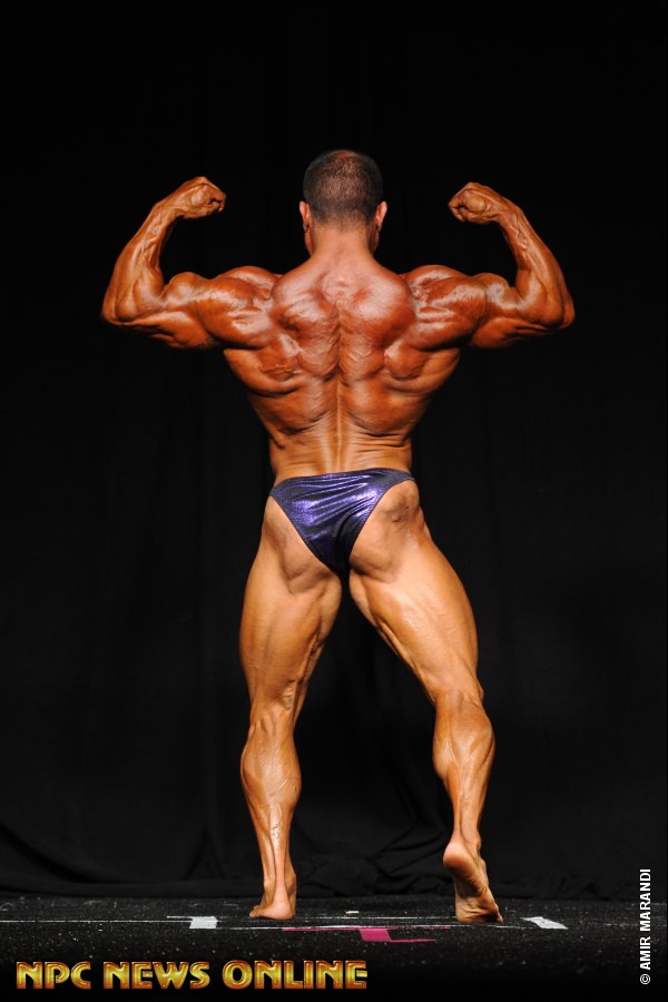 Brett Campanella
