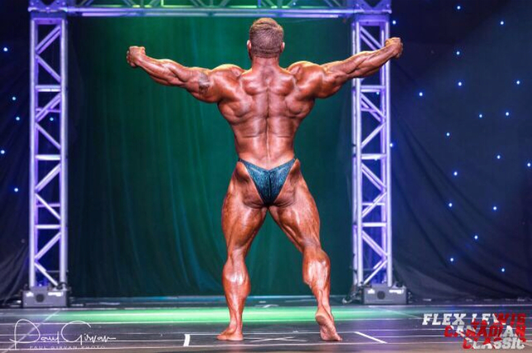 James "Flex" Lewis