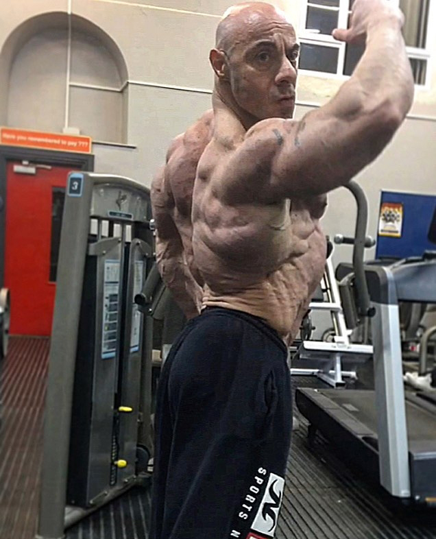 Tony Mount 