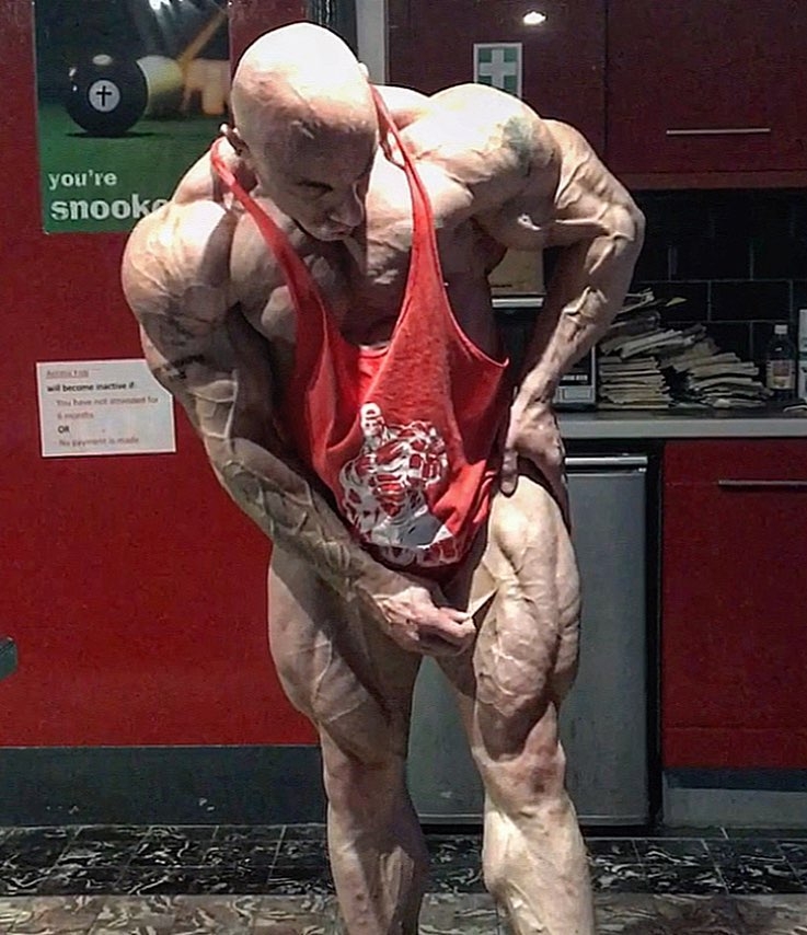 Tony Mount 2,5 t�dne p�ed sout��