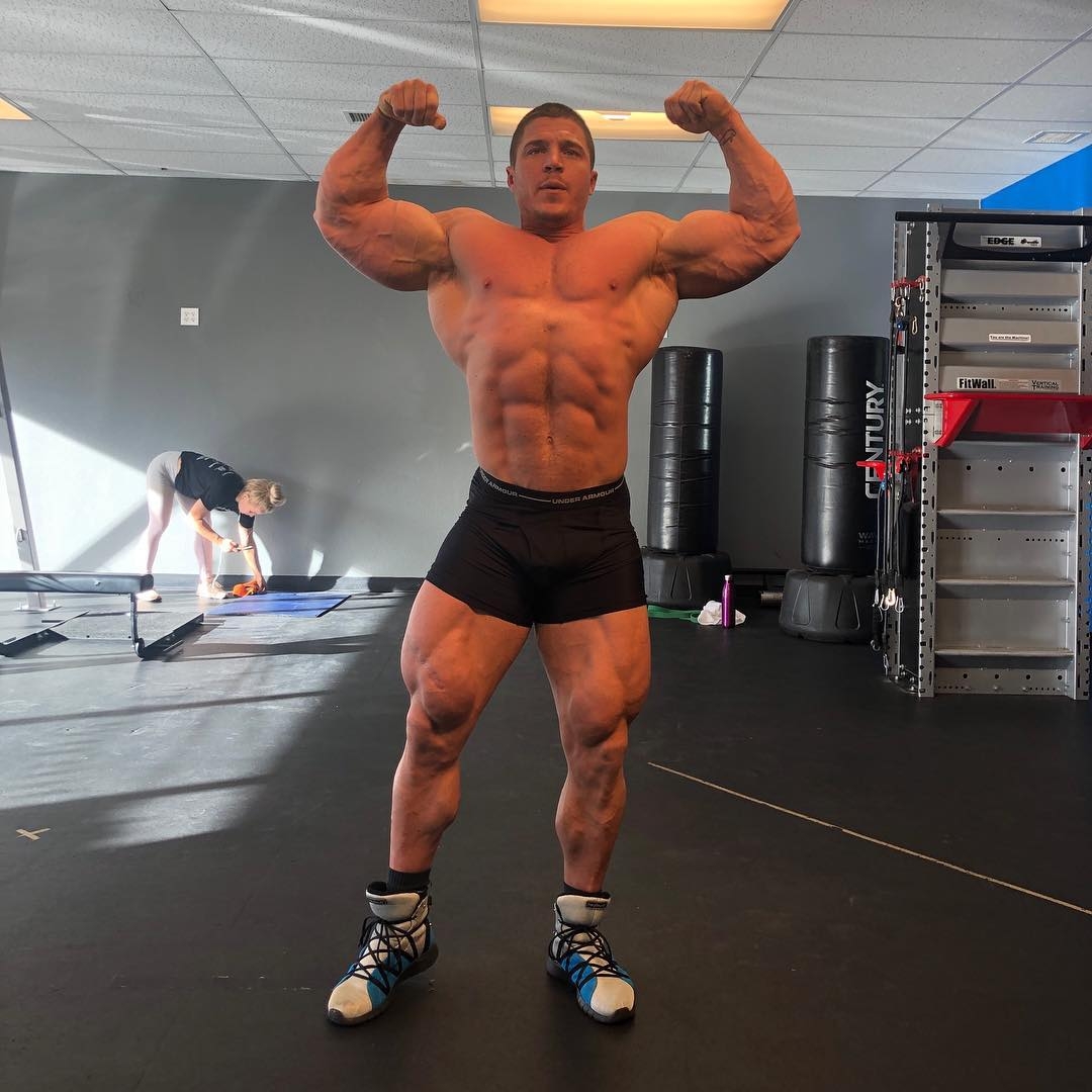 Brett Wilkin