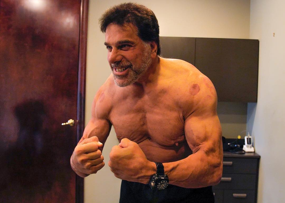 Lou Ferrigno