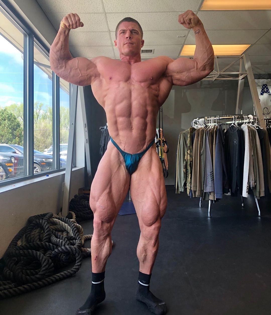 Brett Wilkin
