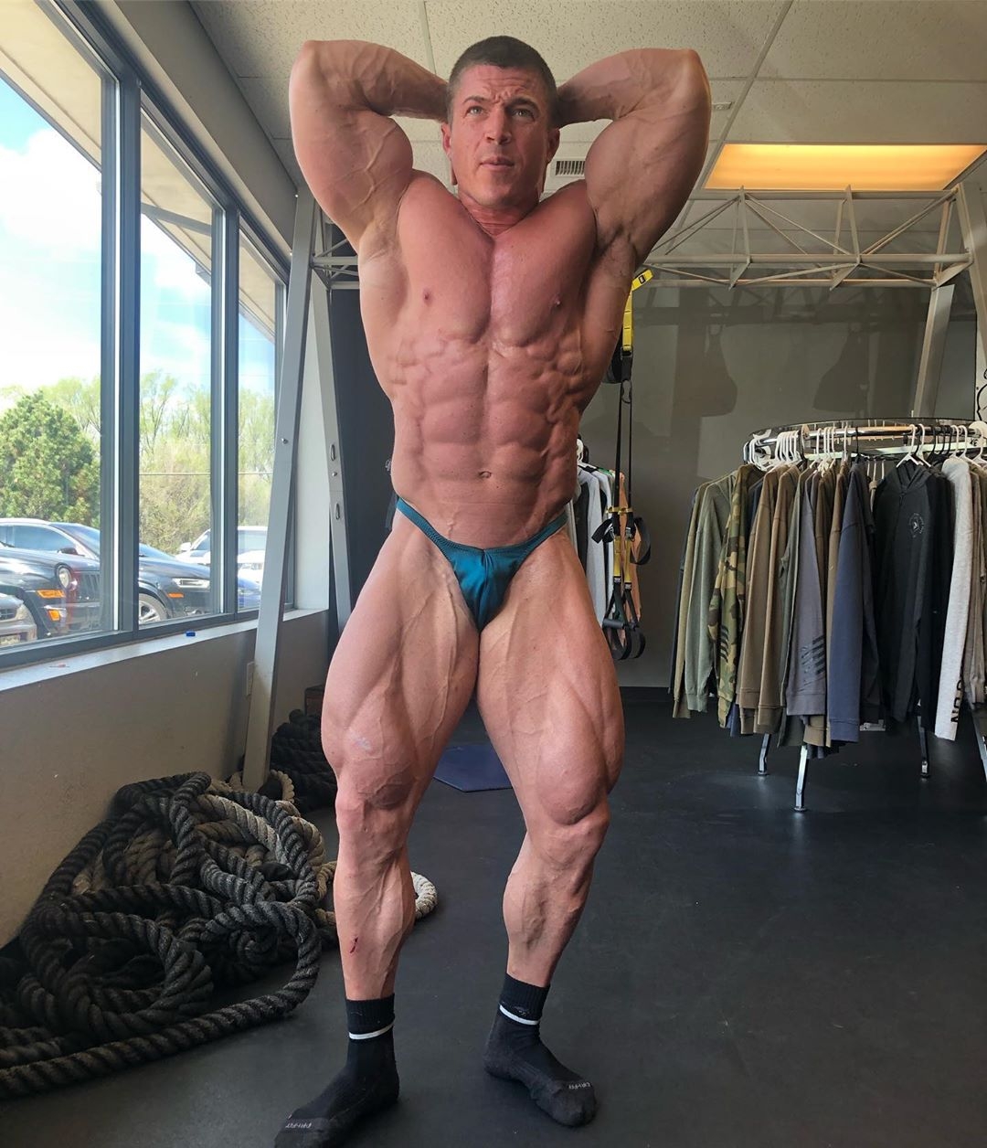 Brett Wilkin