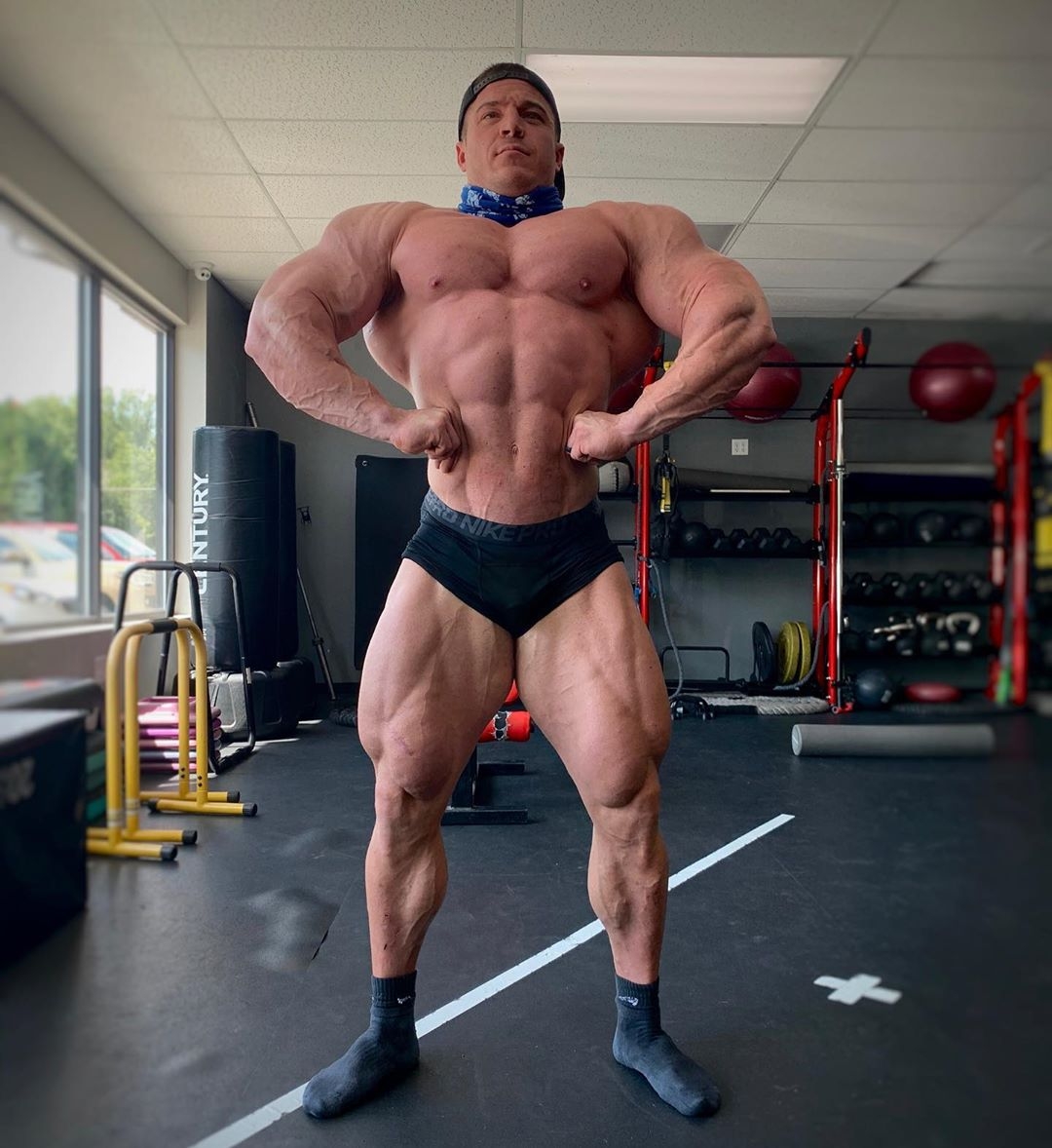Brett Wilkin