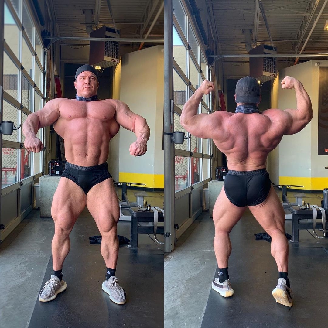 Brett Wilkin