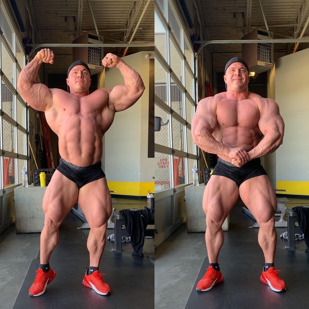 	 Brett Wilkin