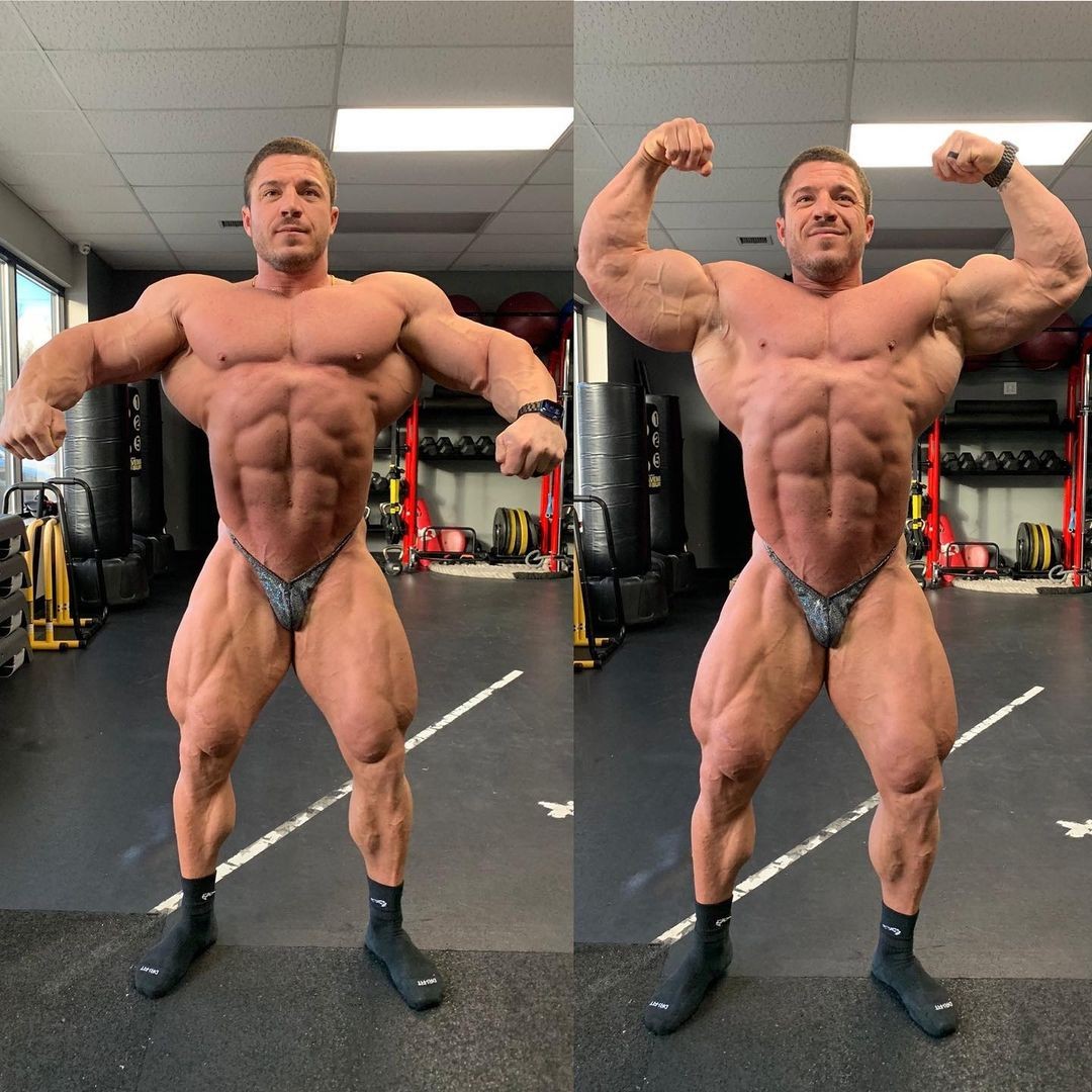 Brett Wilkin