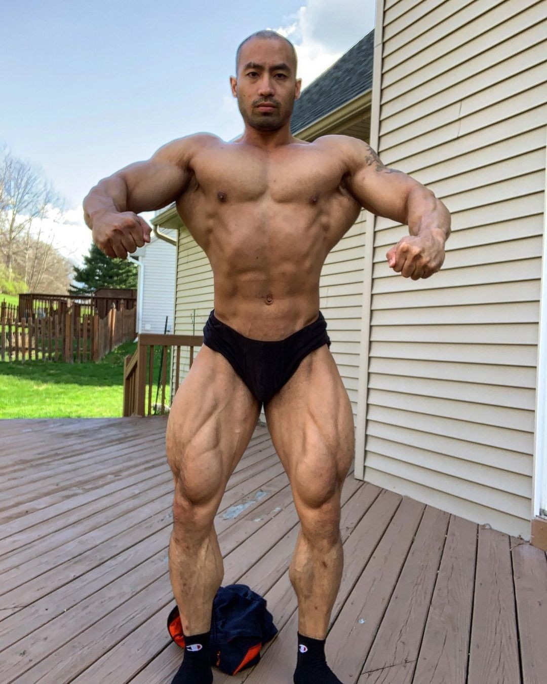 Eric Abelon