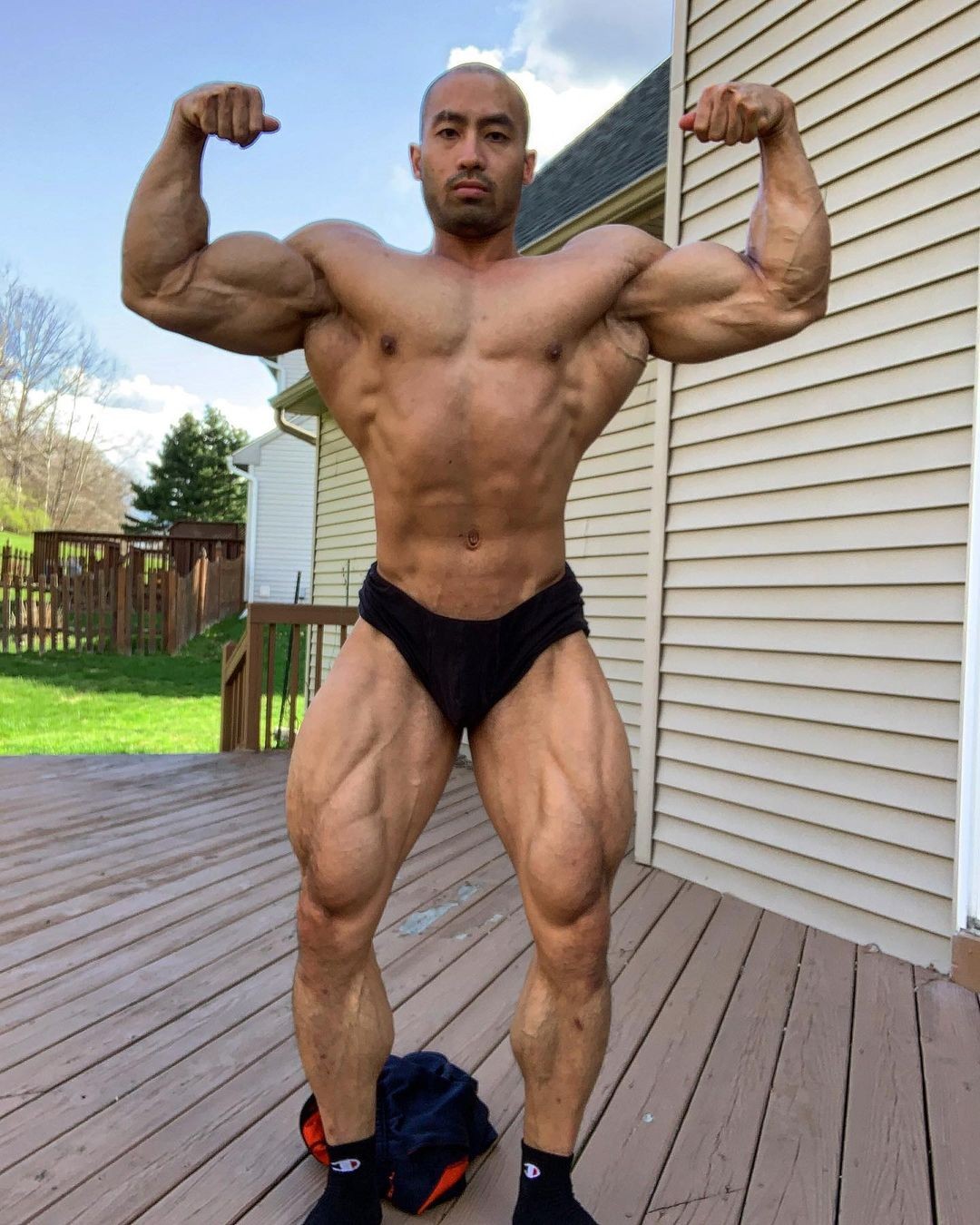 Eric Abelon