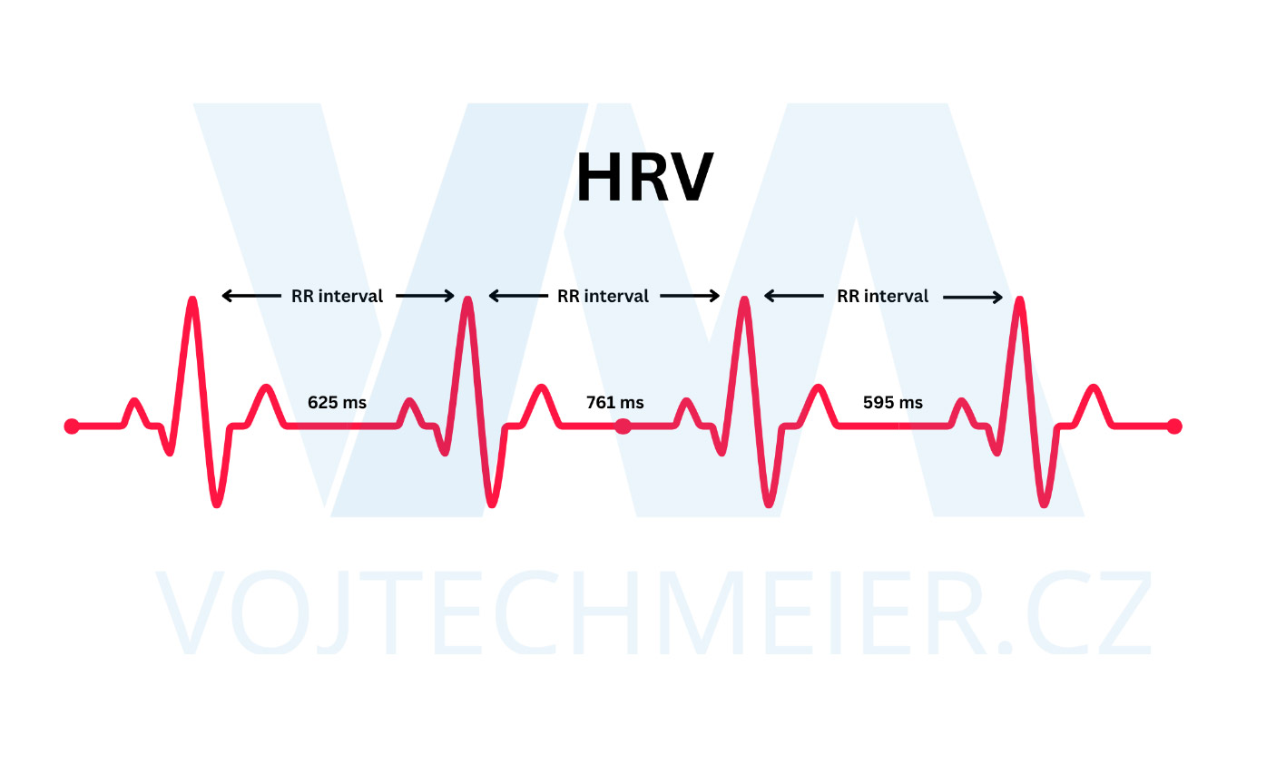 Grafick� zn�zorn�n� HRV (R-R interval) 